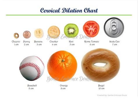 Cervical Dilation Chart Printable