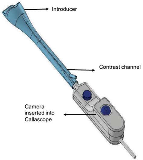 Cervical Imaging in the Low Resource Setting Encyclopedia MDPI