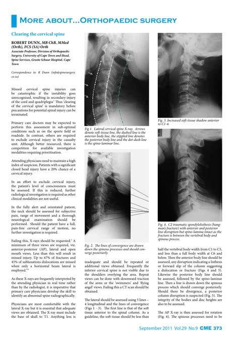 Cervical Spine Clearance - Aspirus Library