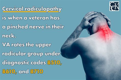 Cervical radiculopathy disability rating. March 1, 2022. What is the Cervicalgia VA Rating? Here’s 3 Ways to Get a VA Disability Rating for Neck and Shoulder Pain. Last updated on December 6, 2022. I hope you … 