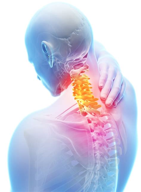 Request an Appointment. 410-955-5000 Maryland. 855-695-4872 Outside of Maryland. +1-410-502-7683 International. Find a Doctor. Find a Treatment Center. Cervical spondylosis is a type of arthritis that affects your neck. This condition becomes more common with age, and most people who are older than 60 have it.