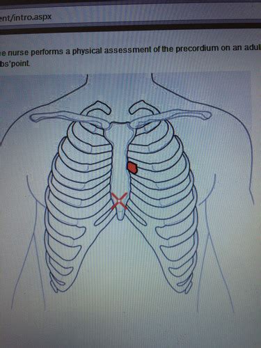 Chapter 15 NCLEX Flashcards Quizlet