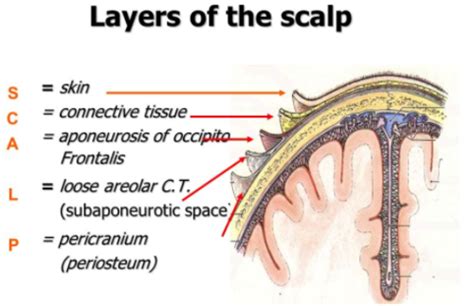 Chapter 15. Scalp, Skull, and Meninges - AccessMedicine