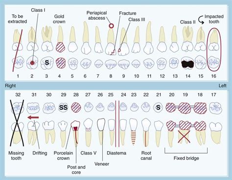 Chapter 7: Tooth wear - GOV.UK