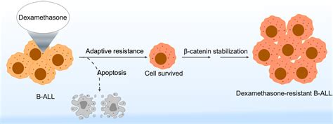 Characterization of a novel glucocorticoid-resistant human B-cell …