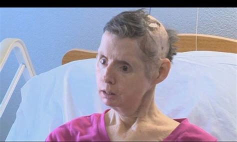 CHARLA NASH suffered horrific injuries after being mauled by her friend Sandra Herold's pet chimpanzee Travis, who gouged out her eyes, gnawed at her face and hands, and left her with brain damage.
