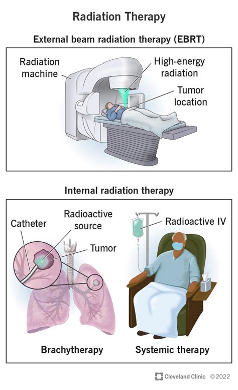 Chemotherapy for Cancer: How It Works, Chemo Side …