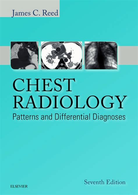 Chest Radiology Patterns And Differential Diagnose