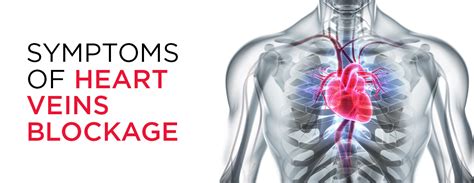 Chest pain and Diagonal Branch blockage - Heart Disease - MedHelp