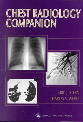 Chest radiology companion methods guidelines and imaging fundamentals imaging companion. - A legal guide for student affairs professionals by william a kaplin.