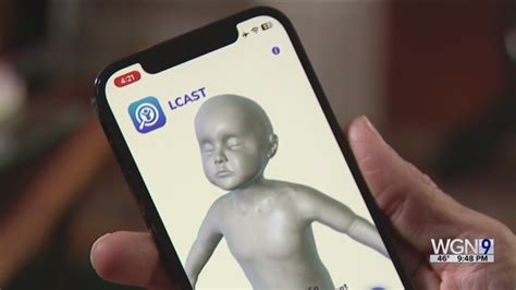 Chicago doctor develops app to help assess possible child abuse