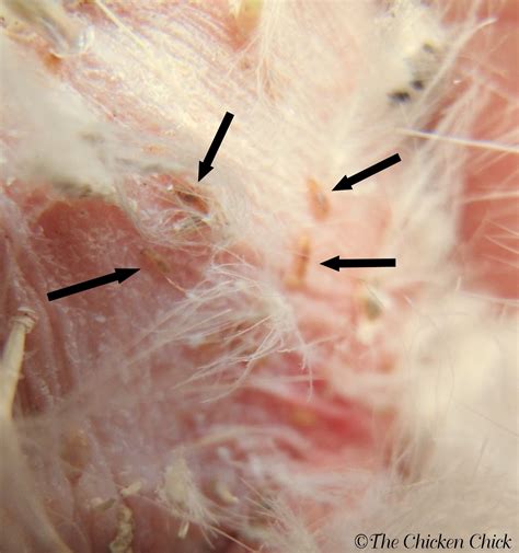 Chicken mite. Jun 21, 2021 ... Chicken parasites are a given in most backyard coops. External parasites — lice, mites, fowl ticks, and chiggers — are the creepy-crawlies ... 