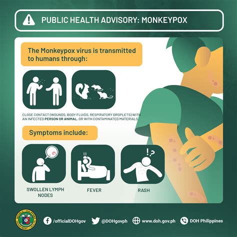 Chickenpox Department of Health website - doh.gov.ph