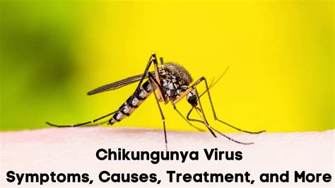 Chikungunya fever DermNet