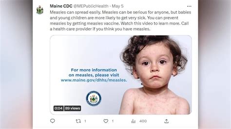 Child in Maine tests positive for measles, first case in state since 2019