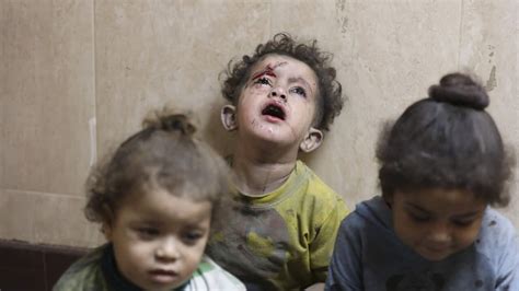 Children wounded by the war in Gaza tell their experiences as they recover in the U.S..