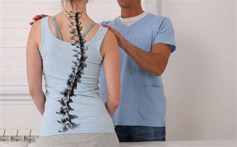 Chiropractic Treatment for Degenerative Scoliosis