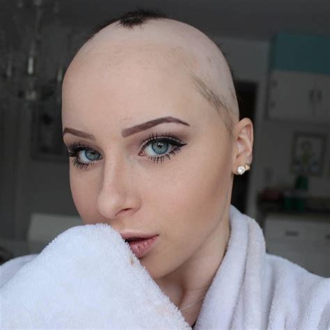 Chloe bean. Hi & welcome to my page🤍 About me... - I was diagnosed with Alopecia at age 8, a huge milestone in my life - Lover of fitness and health - i have been bald three times in my life - Yes, my last ... 
