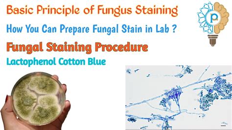 The purpose of this study is to present a new double-staining method that uses cotton blue and safranin to identify fungal structures in plant tissues. With this staining method, the fungal hyphae .... 