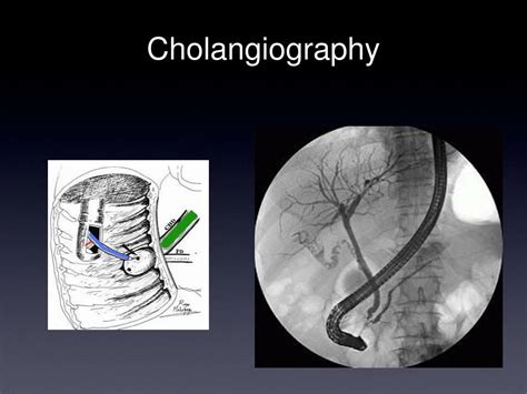 Cholangiography Adalah
