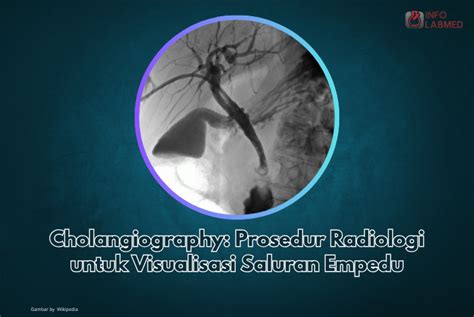 Cholangiography Adalah: Traditional vs. Roth IRA: Which Retirement Account Could Secure Your Future? image 1