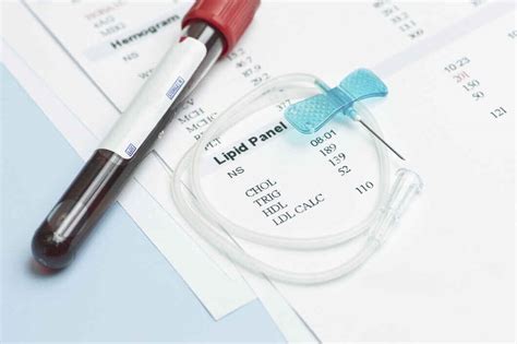 Cholesterol Test Purpose, Procedure and How to Read Reports