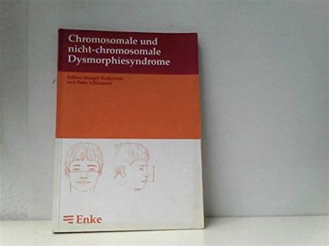 Chromosomale und nicht chromosomale Syndrome SpringerLink