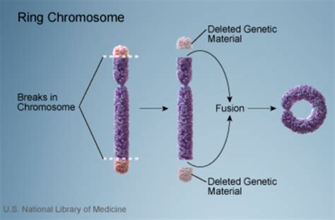 Chromosome 20 trisomy Rare Diseases RareGuru