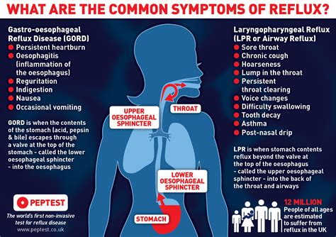 Chronic Cough Due to Gastroesophageal Reflux - CHEST