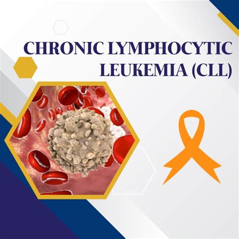 Chronic Lymphocytic Leukemia Know Your CLL