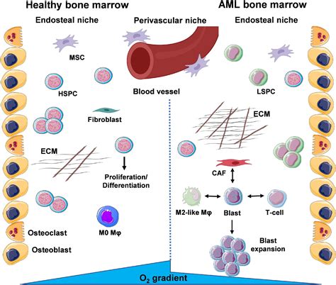 Chronic Myeloid Leukemia - ScienceDirect