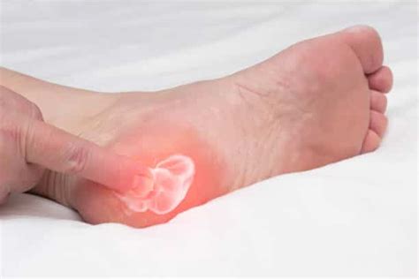 Chronic Plantar Fasciitis: Is It Treatable? - Best Foot Doctor NY