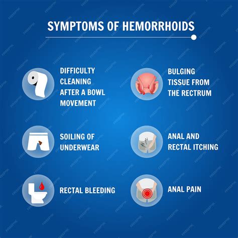 Chronic hemoroids