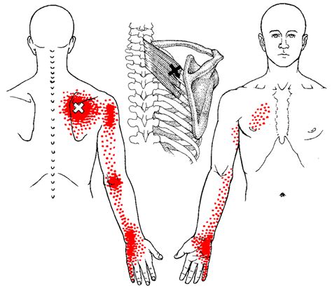 Chronic myofascial pain syndrome the trigger point guide. - The feeling good handbook by david burns.