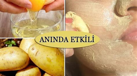 Cilt Beyazlatma Pinterest.