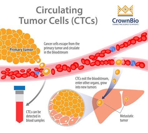 Circulating Tumor Cells