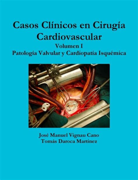 Cirugia vascular volumen uno (volumen uno). - Title solutions manual applied nonparametric statistics.