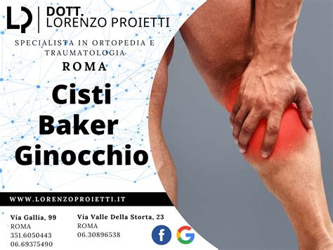 Cisti di Baker: cosa è, cause, sintomi e trattamento