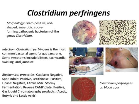 ClOSTRIDIUM perfringens PPT