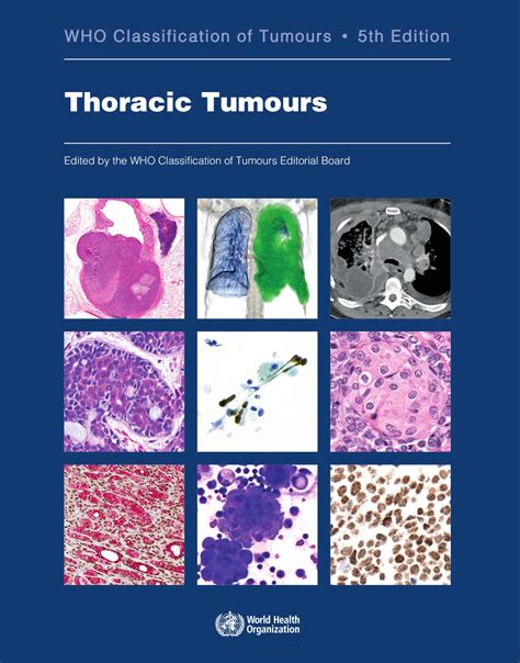 Classification Of Tumours