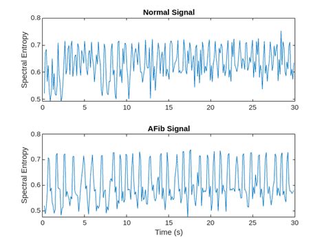 Classify ECG Signals Using Long Short-Term Memory Networks