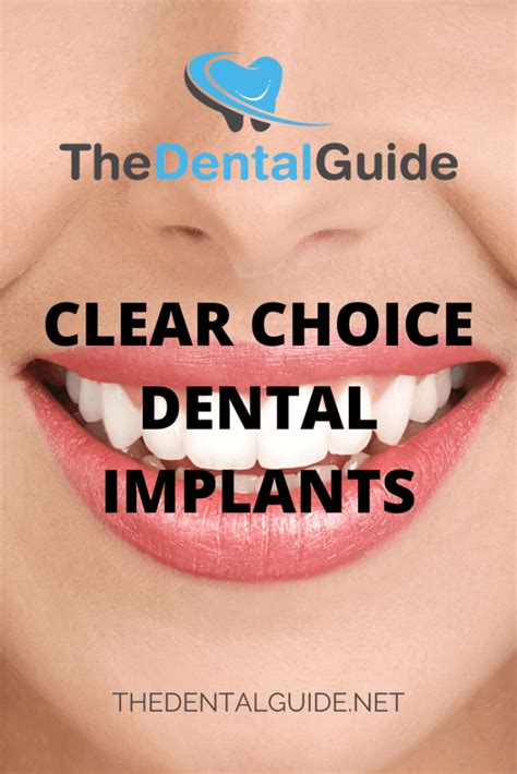 Clear choice dentures. Answer: As with any famous brand, Clear Choice has competitors in the dental implants market. I named some of the best dental implants in the product description and the “My Top Picks at a Glance” section. Still, those are the top companies, and Clear Choice – being newer and focused on dental implants – isn’t as famous as those. 