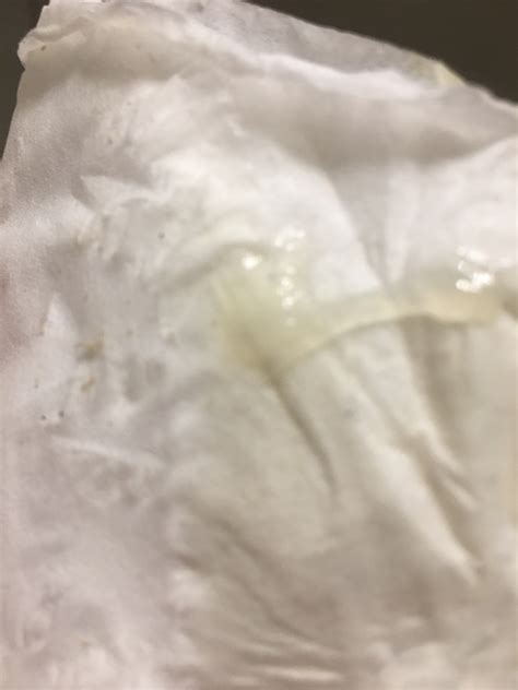 Clear jelly discharge from female dog pregnant. When to see a doctor. Takeaway. Vaginal discharge can vary in color, texture, and volume during pregnancy. Most discharge should be clear or milky white. Other colors, such as green or yellow, can ... 