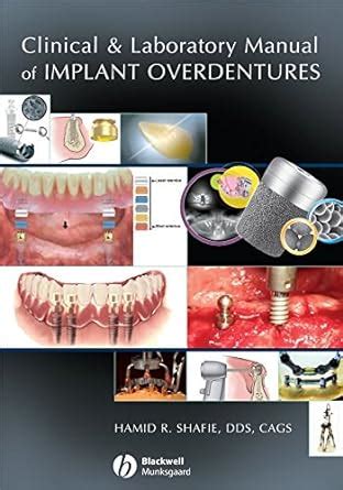 Clinical and laboratory manual of implant overdentures by hamid r shafie. - Repair manual for 1996 ford ranger.