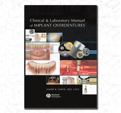 Clinical and laboratory manual of implant overdentures. - The definitive guide to complying with the hipaa hitech privacy and security rules.
