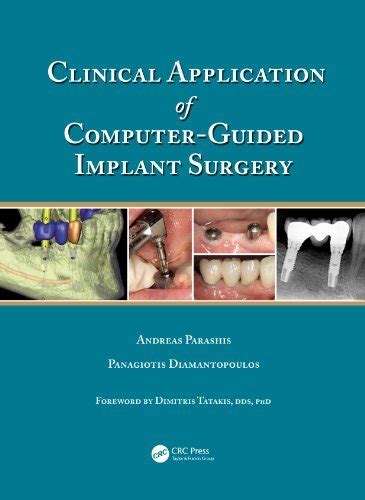 Clinical application of computer guided implant surgery by andreas parashis. - Shawn meghan burn women across cultures a global perspective 3rd edition download free ebooks about shawn meghan burn women.
