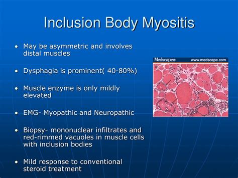 Clinical characteristics of dysphagic inclusion body myositis