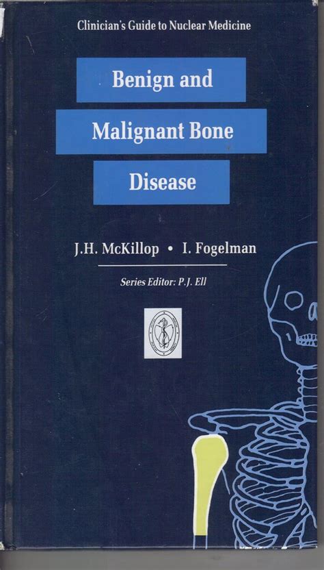 Clinicians guide to nuclear medicine benign and malignant bone disease. - Bose lifestyle model 5 repair manual.