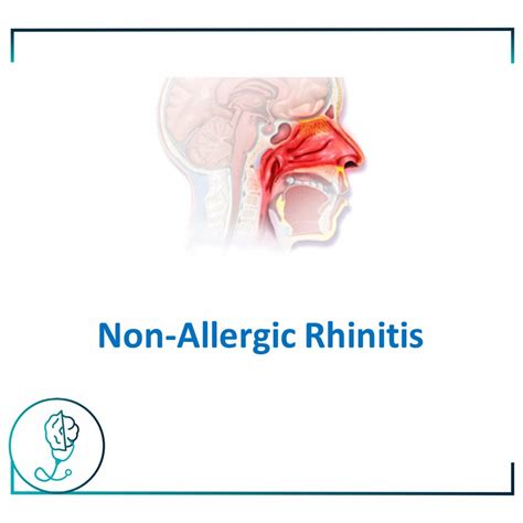 Clinicians manual on allergic and nonallergic rhinitis. - A birthday present from his brat taboo erotica english edition.
