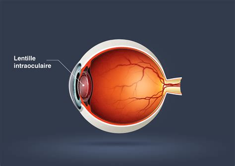 Clinique pour les maladies des yeux ses trois premi©·res ann©♭es d'existence. - User manual for ecomax chf 40.